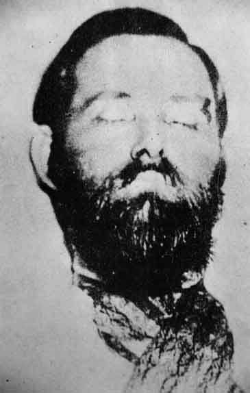 Jesse James autopsy photo
