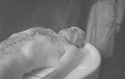 Benito Mussolini autopsy photo