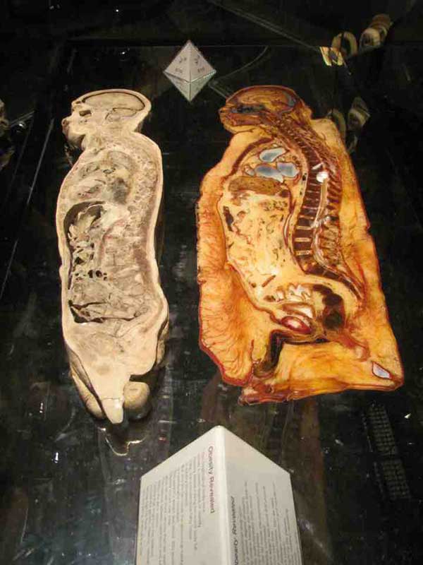 Cross section of a thin person and fat person