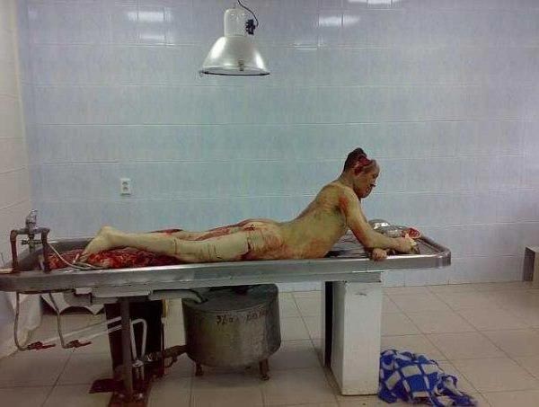 A corpse sitting up on the slab due to the effects of rigor mortis